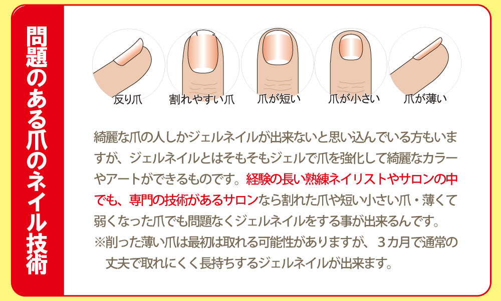 ジェルネイルの常識深爪4