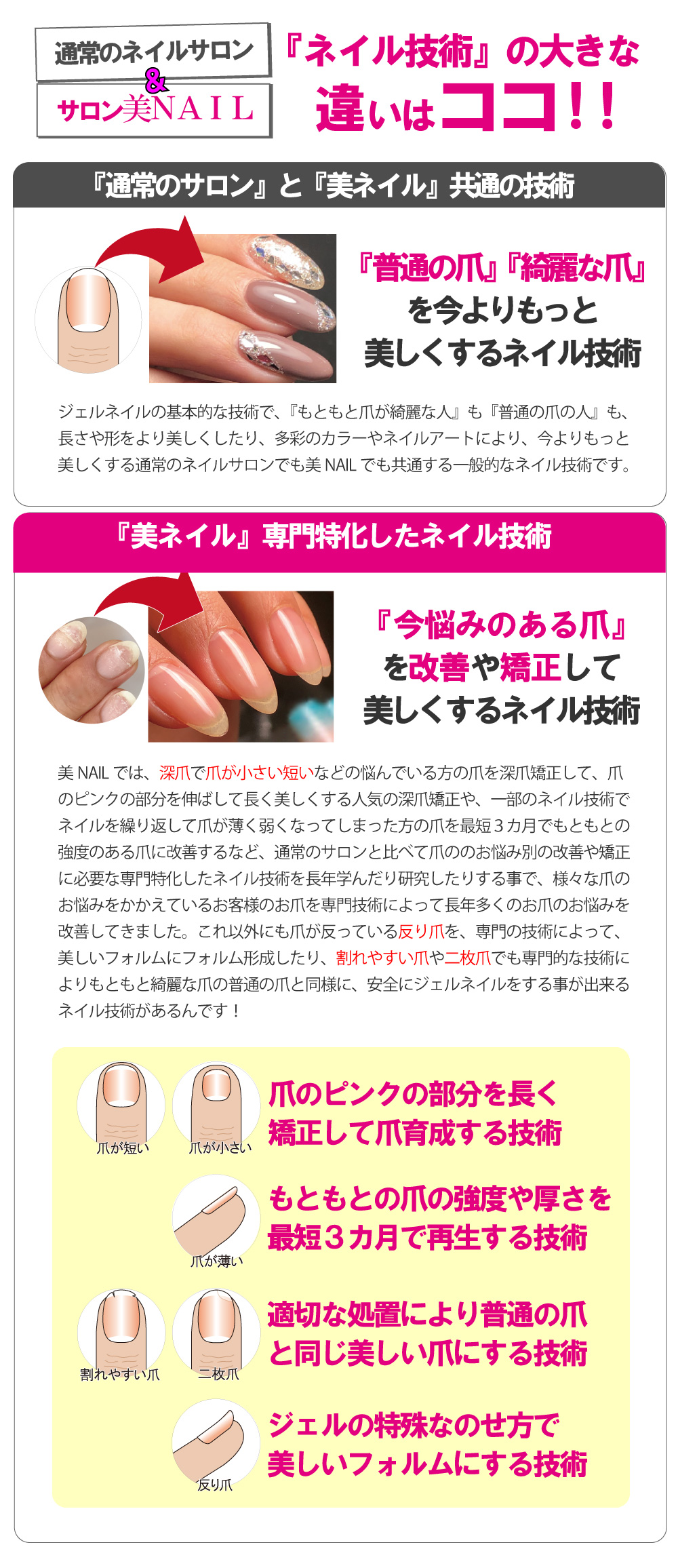 美ネイルの違い
