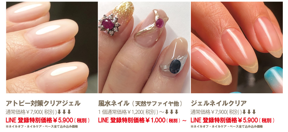 神戸市北区美NAILアトピー対策ネイル