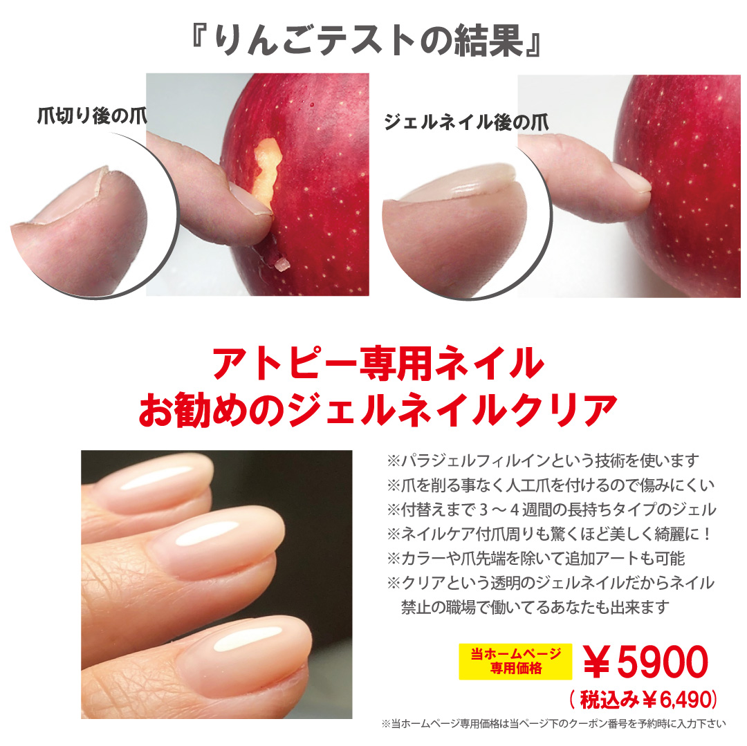 美ネイルの肌傷つけにくいアトピー専用ネイル