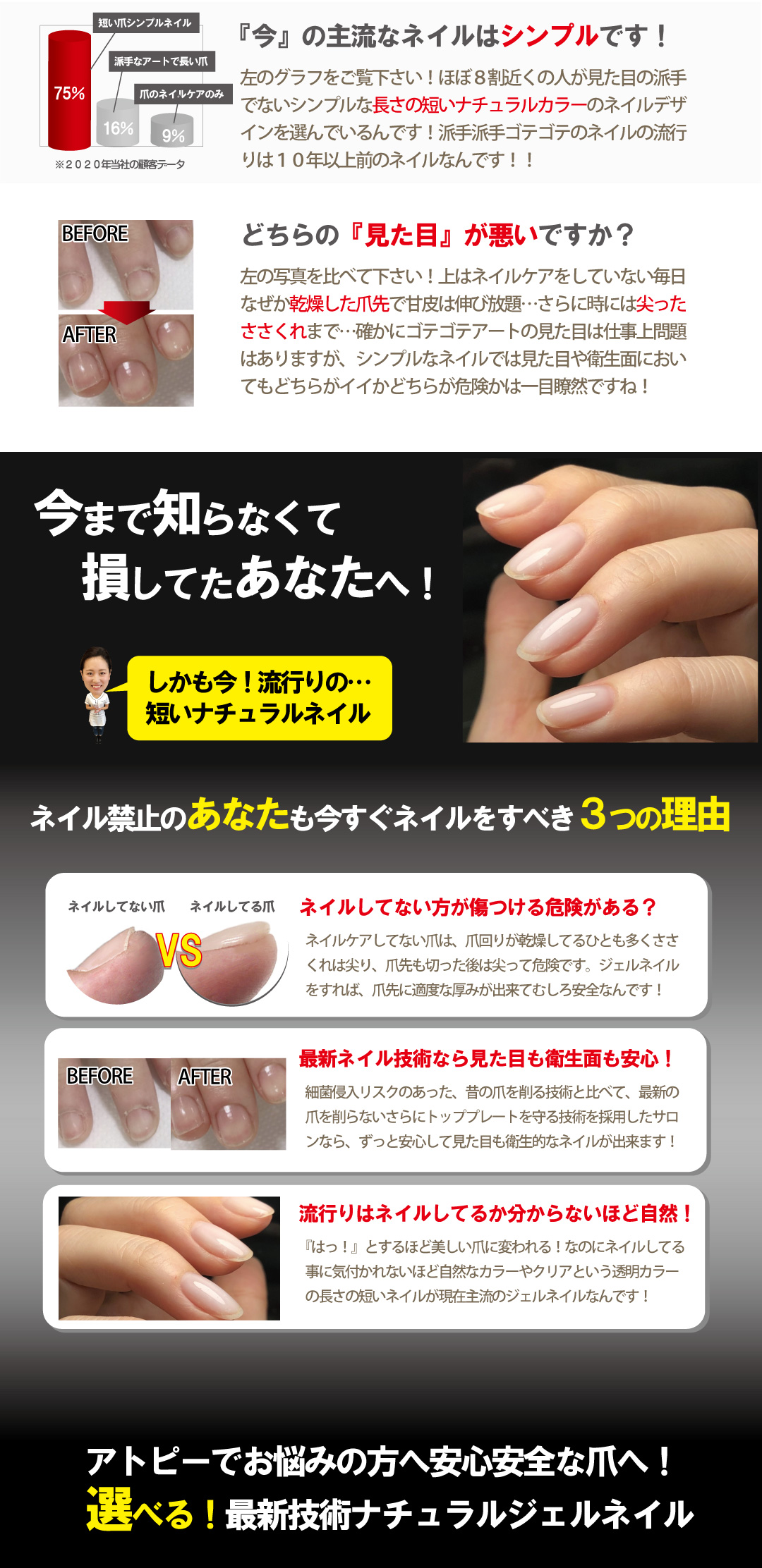 アトピー専用ネイルお勧めの美NAILジェルネイルクリア